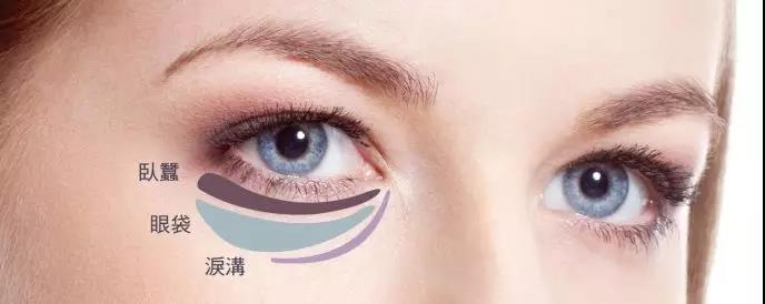 怎么祛眼袋