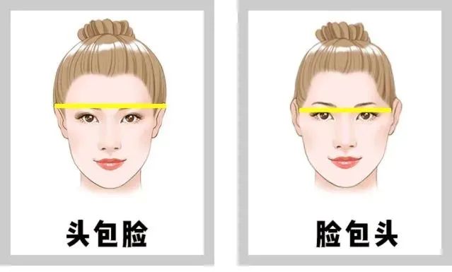 高颅顶发型