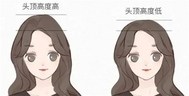 高颅顶和低颅顶对比图