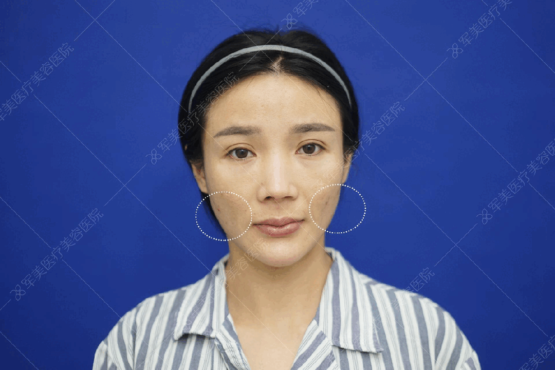 减肥最快效果最好方法