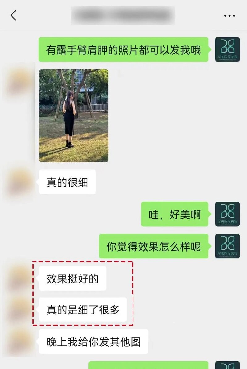 吸脂哪家医院做的好
