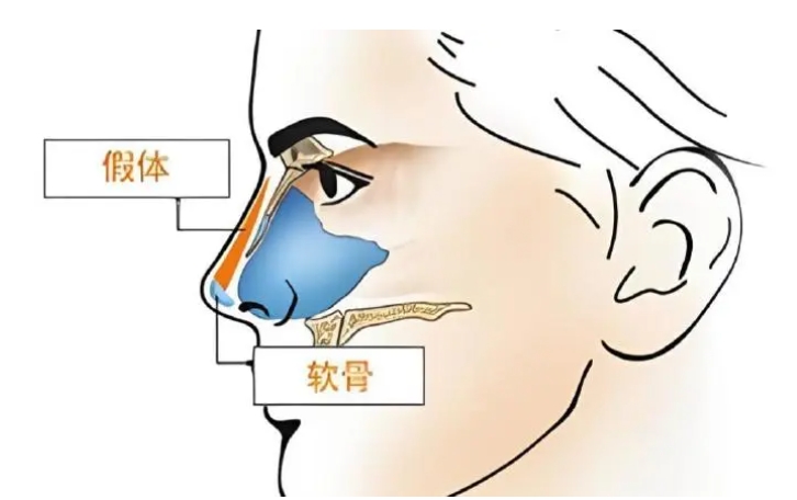 广州鼻子整形医院哪家好