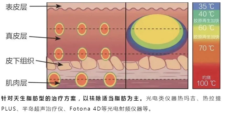 口角囊袋怎么去除最好