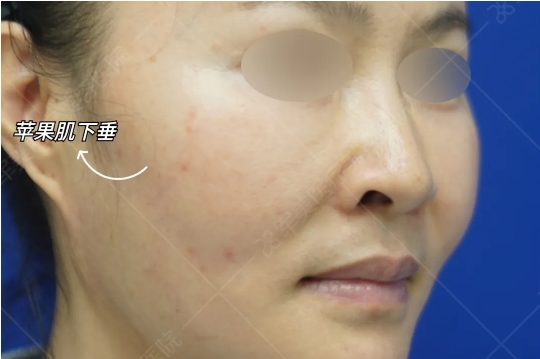 面部年轻化最好的医生王世虎