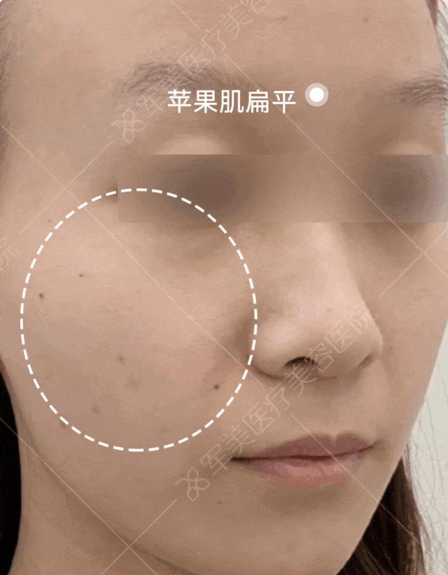 面部年轻化最好的医生王世虎