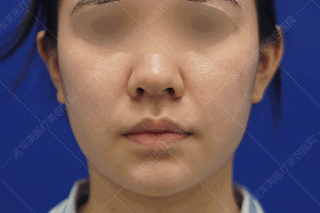 瘦脸最快最有效的方法