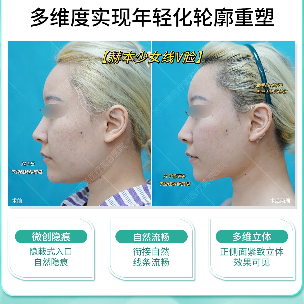 军美医疗美容
