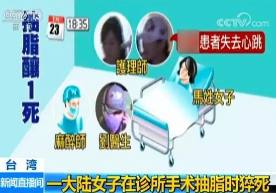 吸脂能减多少斤