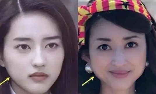 发腮怎么解决