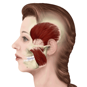 瘦脸针效果案例