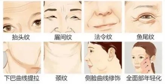 抗衰老的医美项目有哪些
