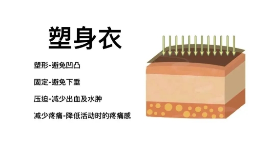 大腿吸脂后可以不穿塑身衣吗