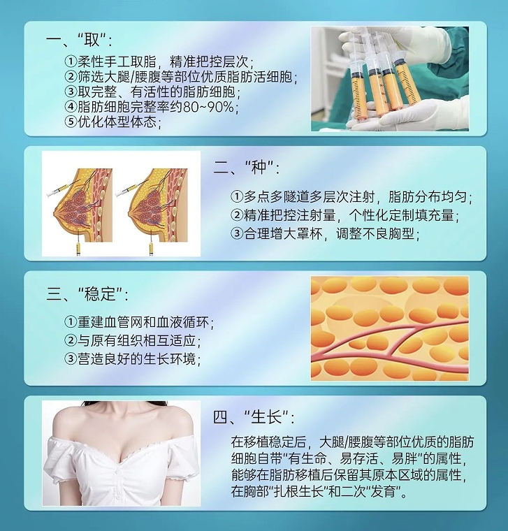 王世虎脂肪胸技术