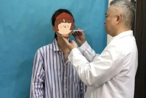 自体脂肪填充能维持多久