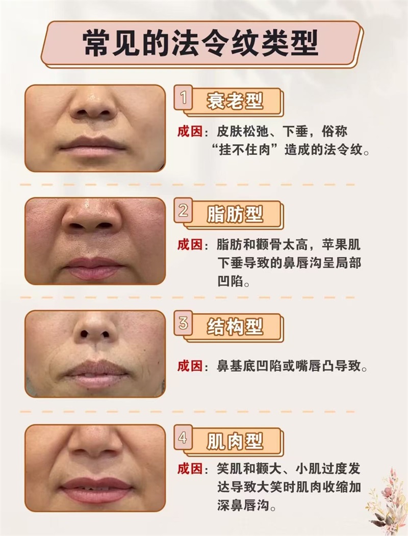 面部衰老怎么改善