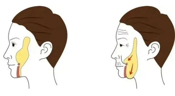 面部抗衰老最好的方法是什么