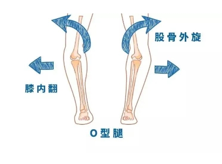 肌肉型小腿怎么瘦