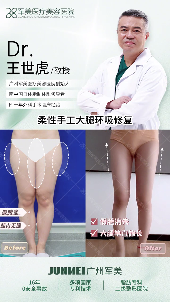 王世虎大腿吸脂修复