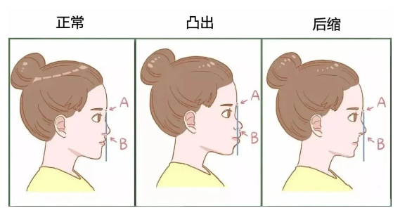 垮脸怎么提升紧致