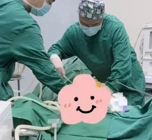 王世虎吸脂瘦大腿案例