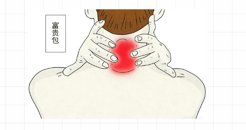 富贵包是怎么引起的