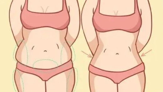 吸脂后注意事项有哪些