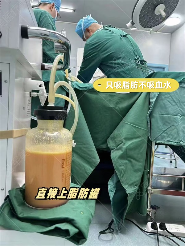 国内吸脂手术哪家好