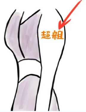 手臂粗壮怎么减最快瘦下来