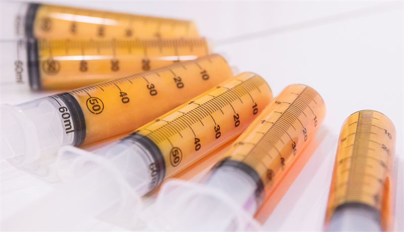 吸脂后的脂肪可以用来做什么