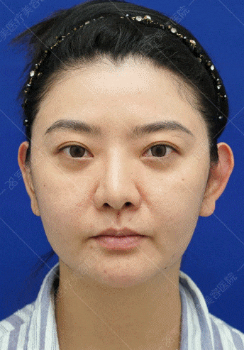 军美少女线v脸案例