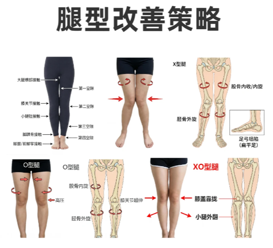 腿型矫正