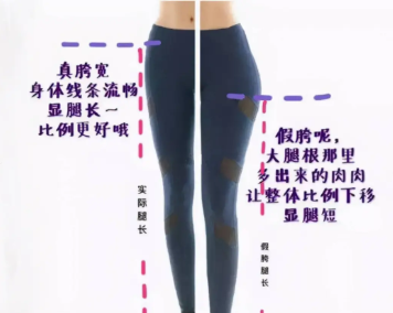 大腿吸脂后会显腿长吗