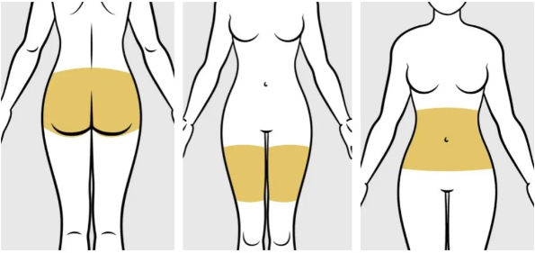 女性易发胖的部位