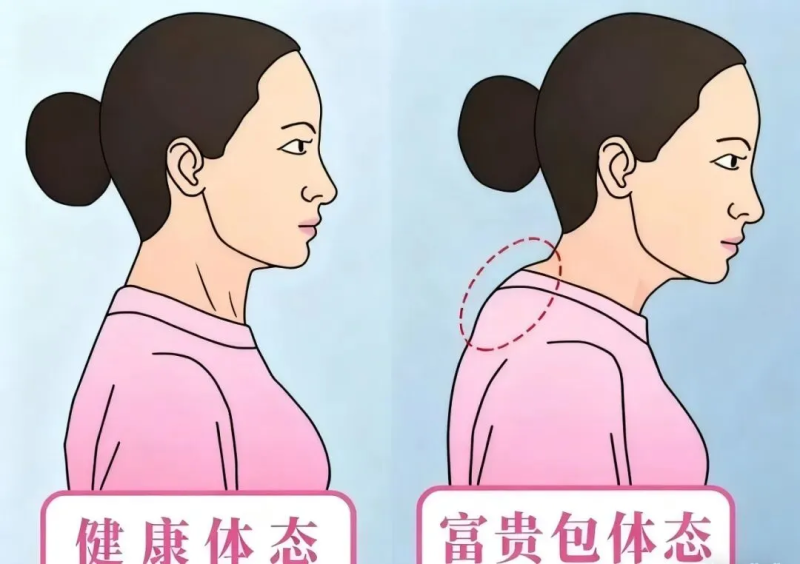 富贵包怎么改善